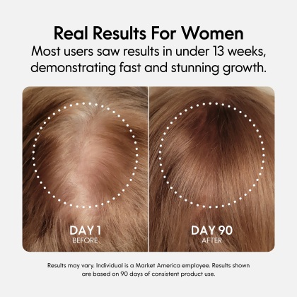 Fixx Hair Growth alternate image