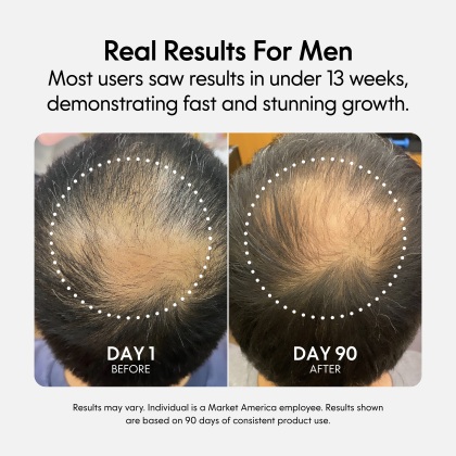 Fixx Hair Growth alternate image