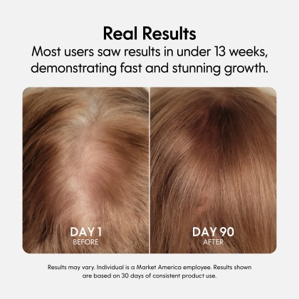 Fixx&trade; Hair Growth Serum alternate image