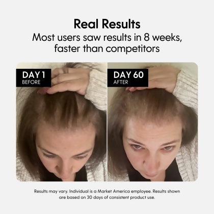 Fixx&trade; Hair Growth Serum alternate image