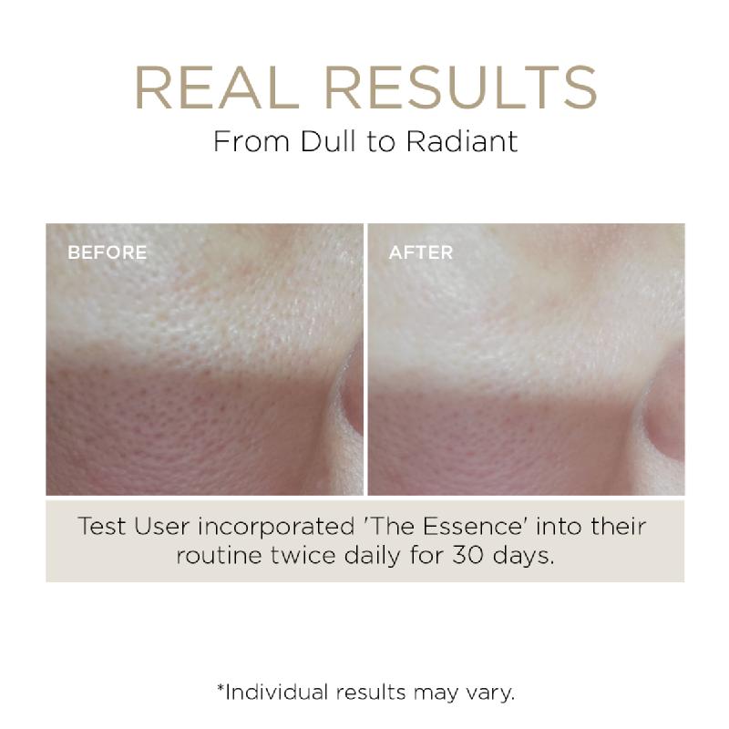 Lumière de Vie&reg; The Essence (Hydrating Tonic)