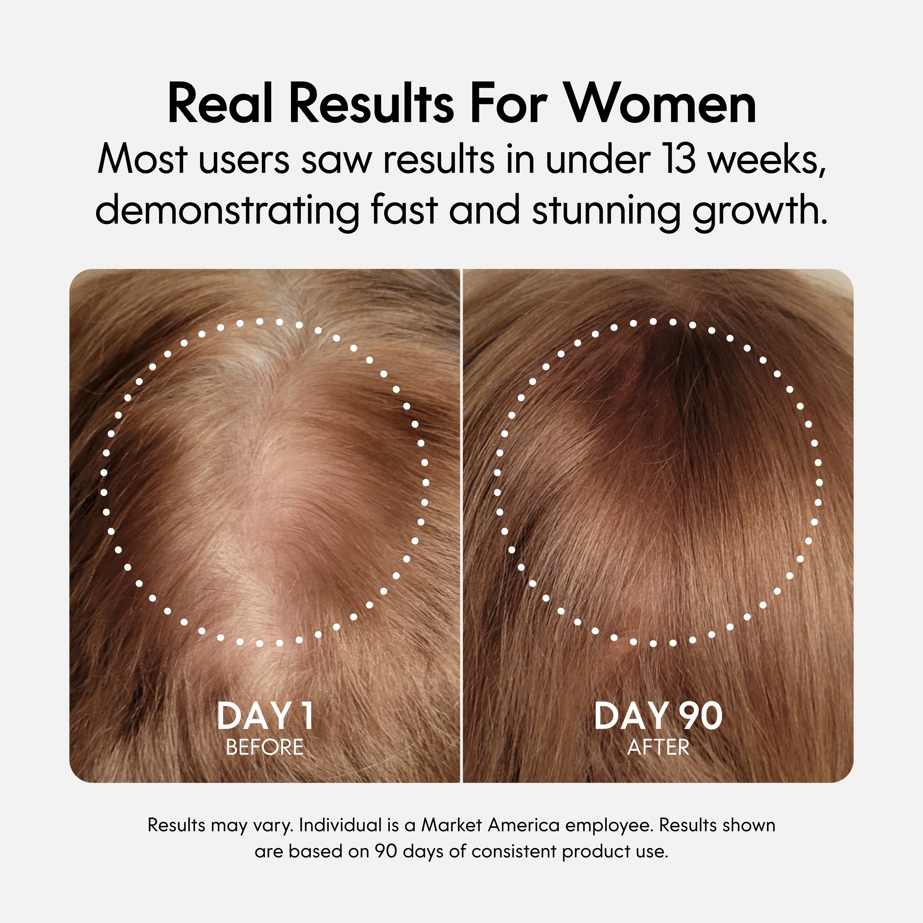 Fixx Hair Growth