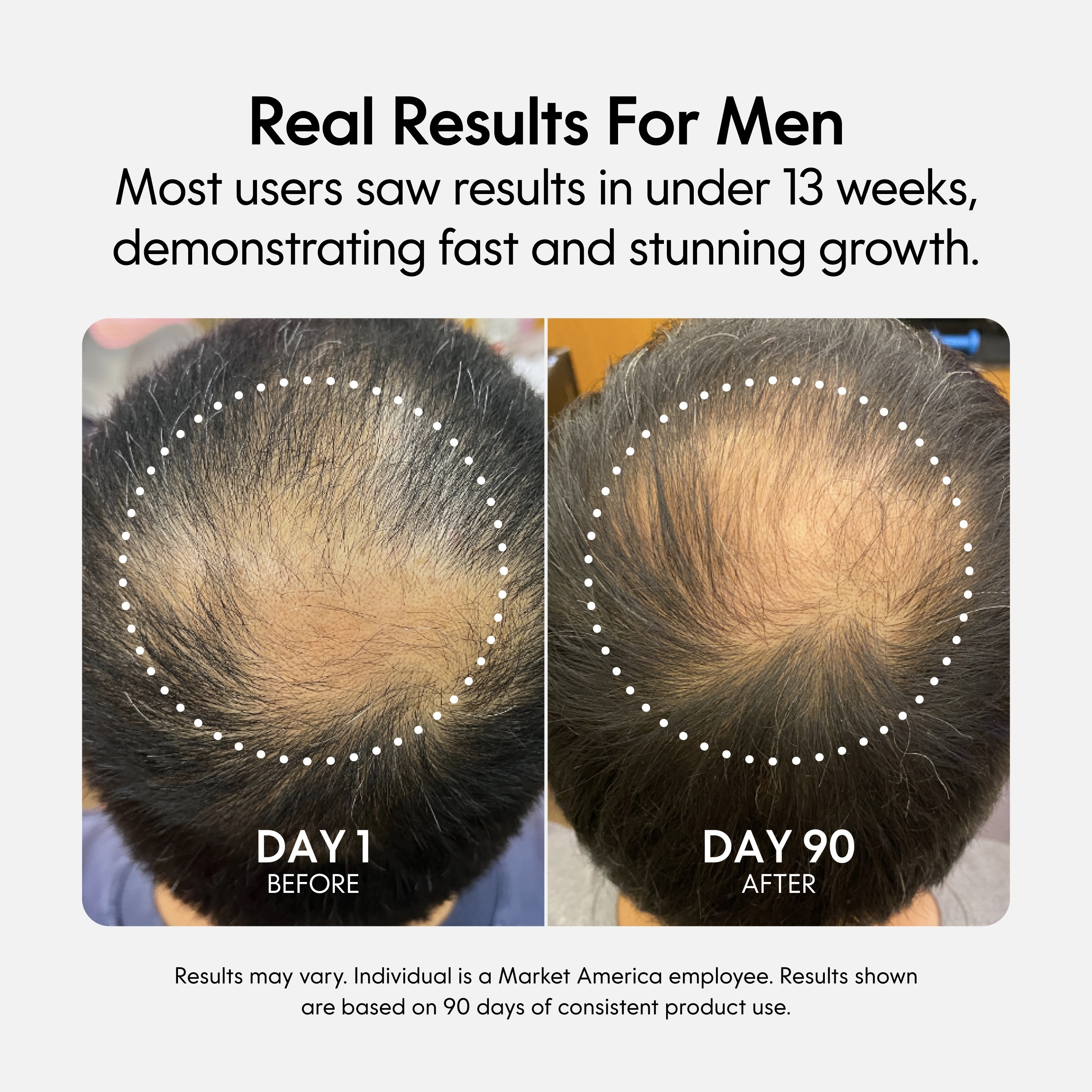 Fixx Hair Growth