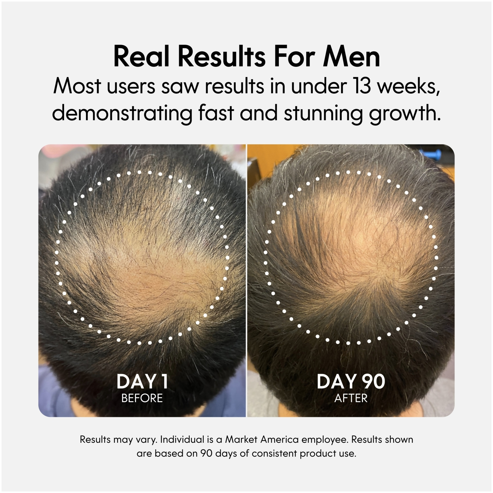 nutraMetrix® Fixx Hair Growth