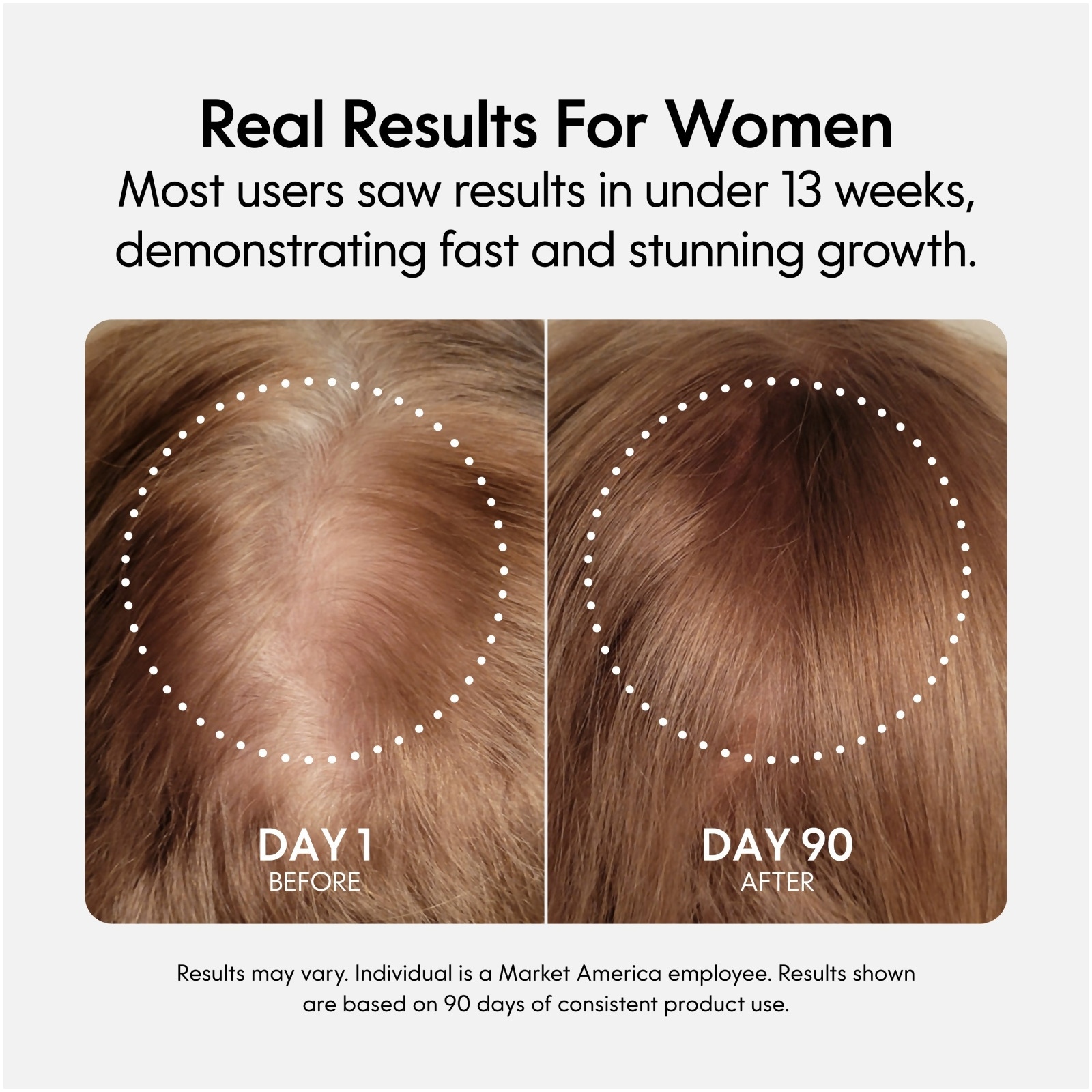 nutraMetrix® Fixx Hair Growth