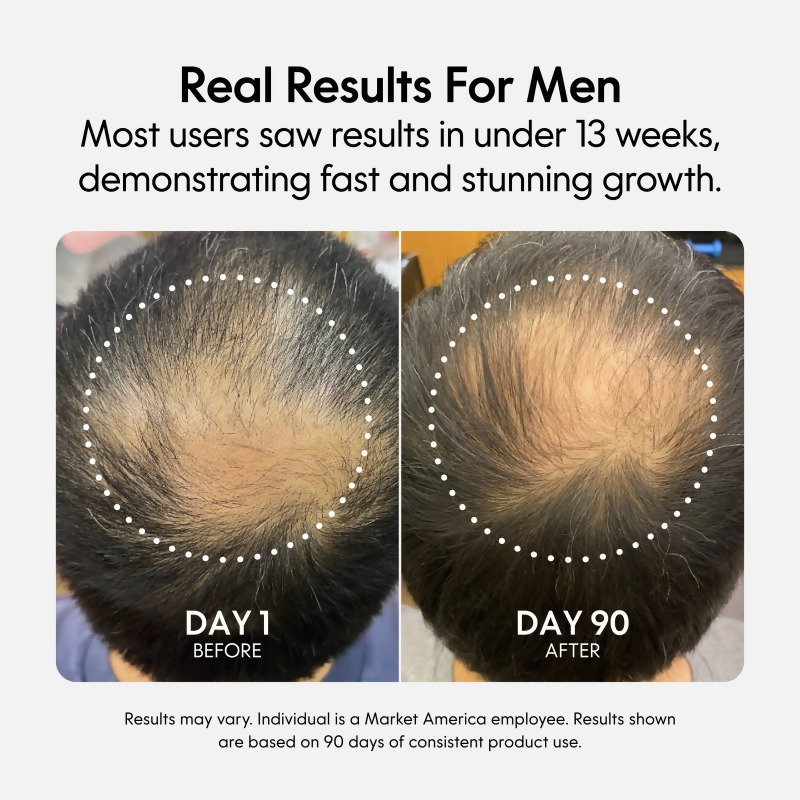 nutraMetrix&reg; Fixx Hair Growth