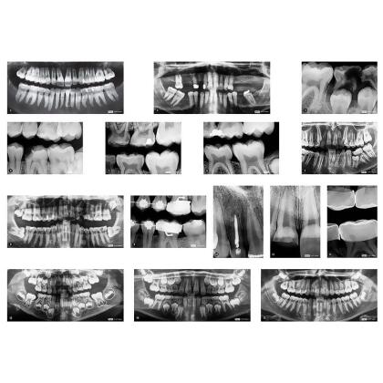Roylco R-59269 Dental X-Rays for Age 5Plus 