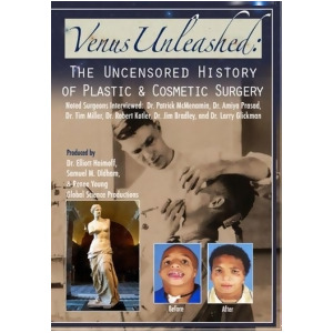 Mod-venus Unleashed-uncensored Hist Of Plastic Surgery Dvd/non-returnable - All