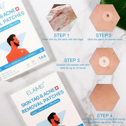 144pcs Skin Tag Acne Removal Patch alternate image