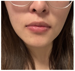 Customer Review Image 1 of 5, Zoom In