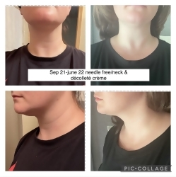 Customer Review Image 1 of 3, Zoom In