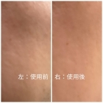 Customer Review Image 1 of 1, Zoom In
